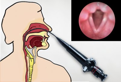 Imagem - Videonasoscopia e Videolaringoscopia Flexível